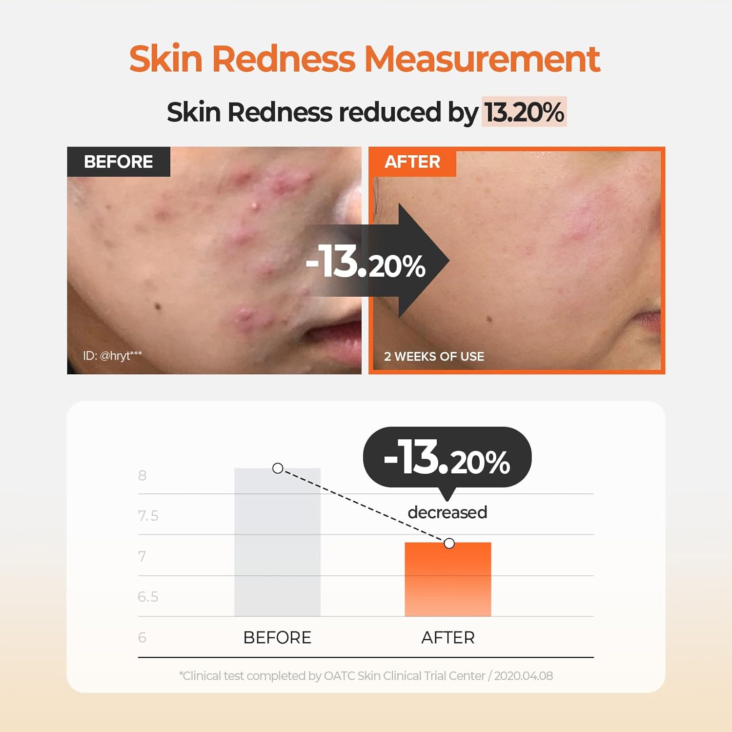 [Skinfood] Carrot Carotene Calming Water Pad (60 pads)