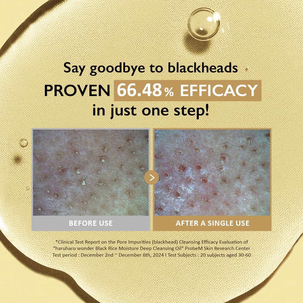 [Haruharu Wonder] Black Rice Moisture Deep Cleansing Oil 150ml