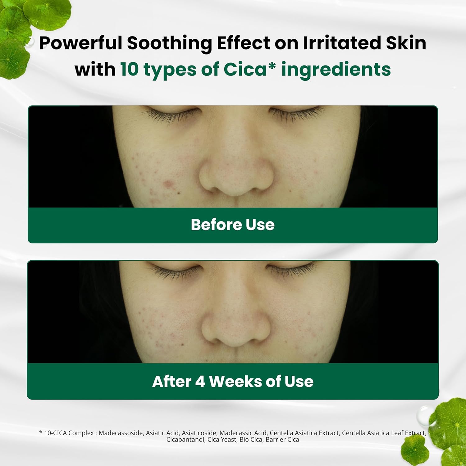 [Doctor.G] Red Blemish Clear Soothing Cream 70ml (2023)