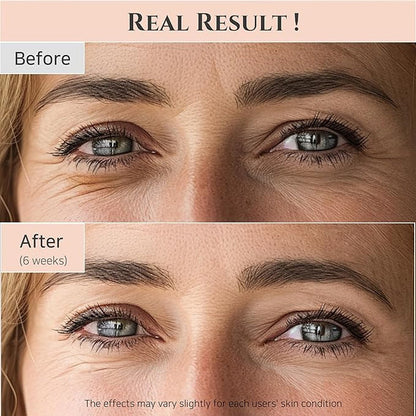 [Beauty of Joseon] Revive Eye Serum: Ginseng + Retinal 30ml