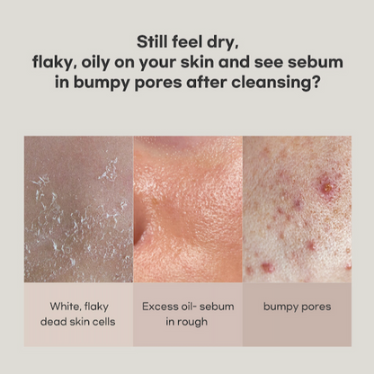 [benetus] Lacto Skin Toner 150ml