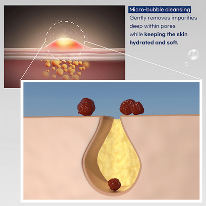 [benetus] Lacto Alaska Bubble Foam 200ml