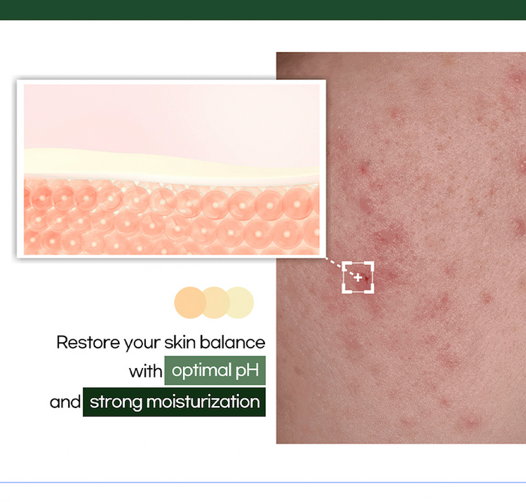 Skincare product packaging with skin texture illustration and text about restoring skin balance.