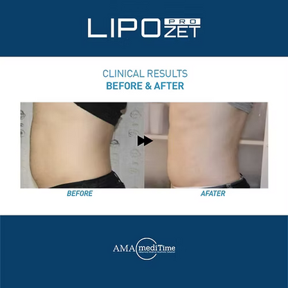 Lipozet Pro