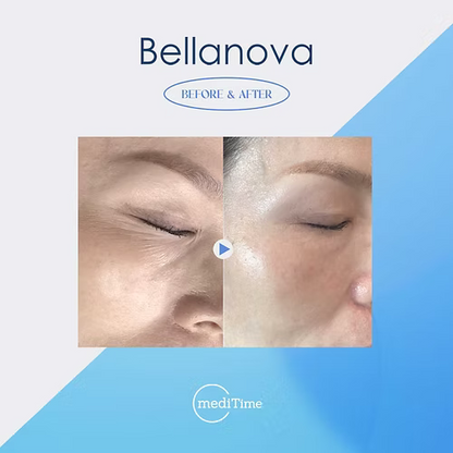 Bellanova Nano Mist Therapy System