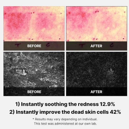 [Medicube] Super Cica Toner Pad (70 pads)