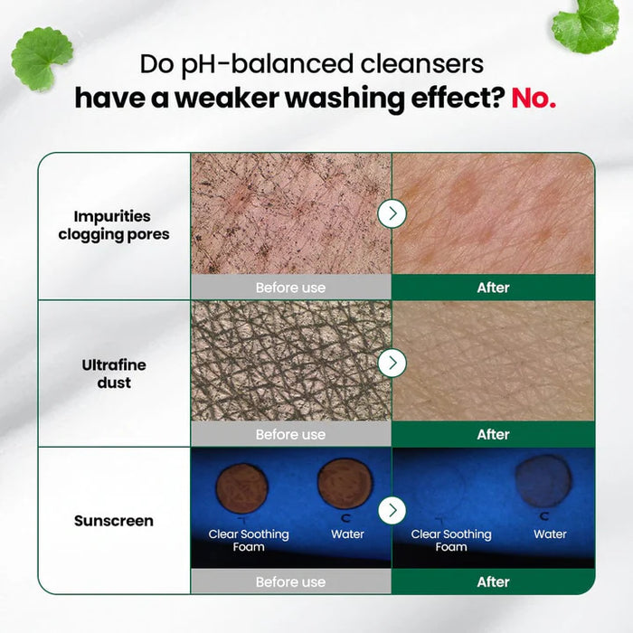 [Doctor.G] pH Cleansing RED Blemish Clear Soothing Foam 150ml