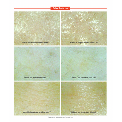 Centella Red Cream - Image 10