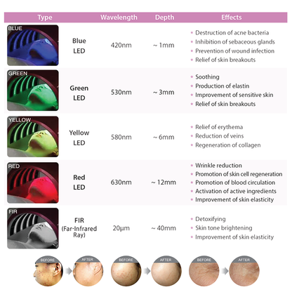 Beautylight II Photo Dynamic Thermo Therapy - Image 3