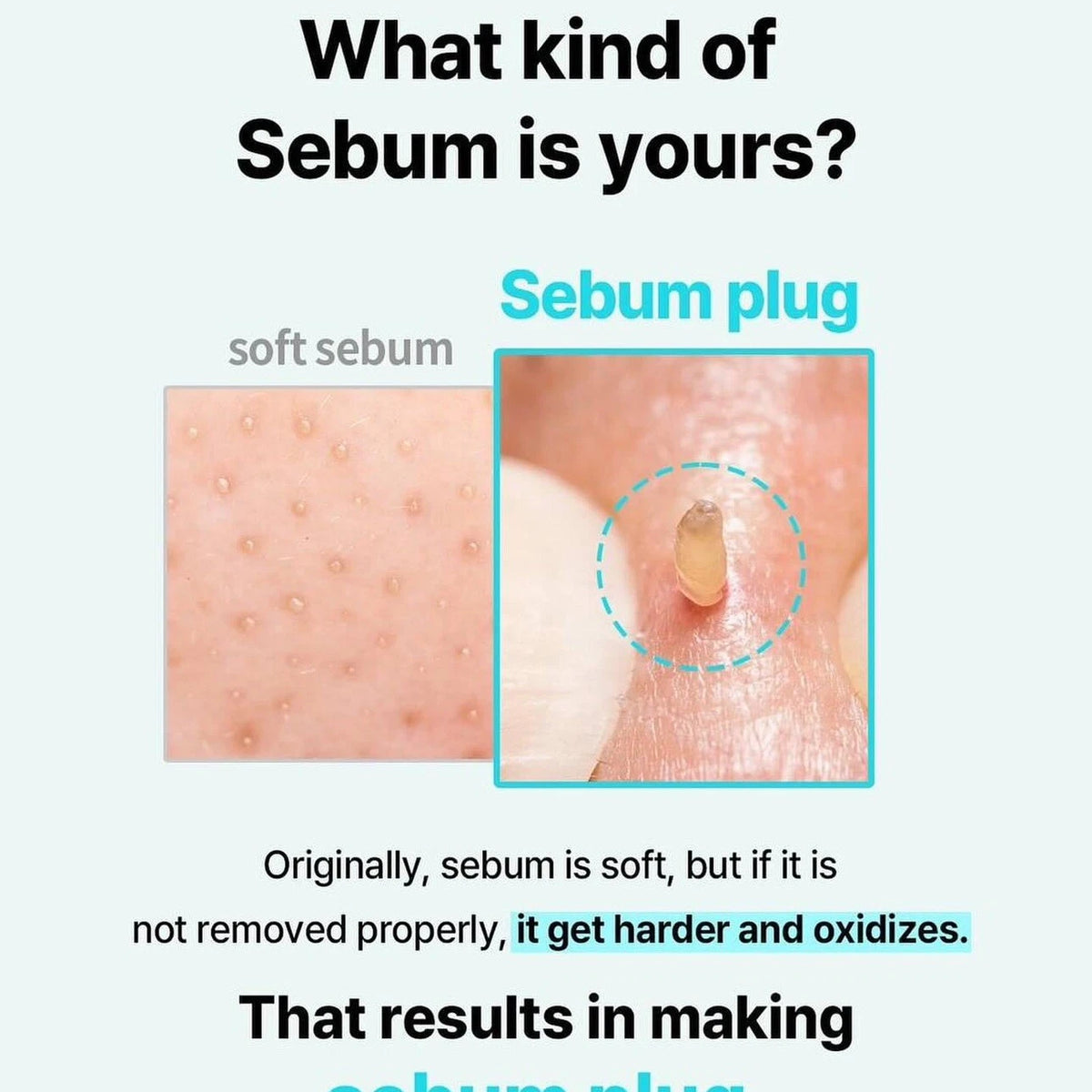 [Ilso] Super Melting Sebum Softener 150ml