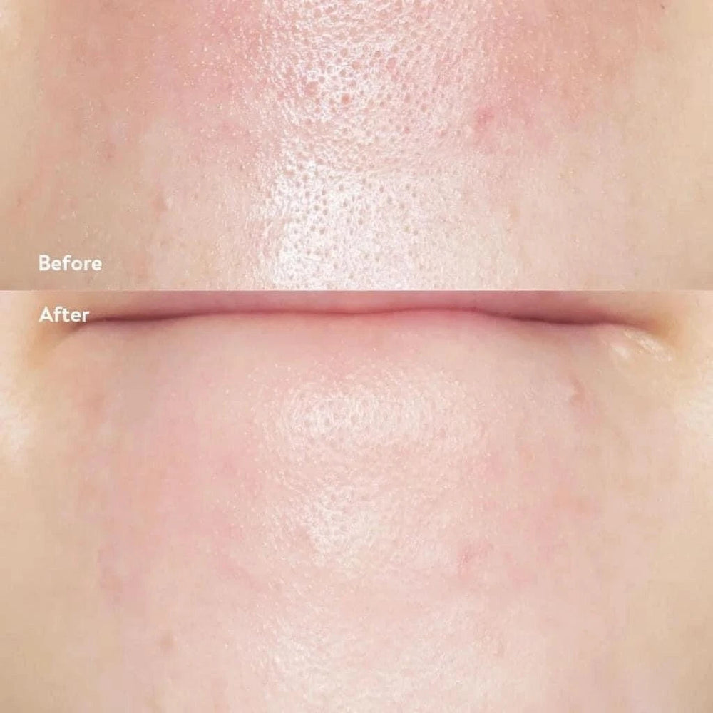 [Ilso] Super Melting Sebum Softener 150ml