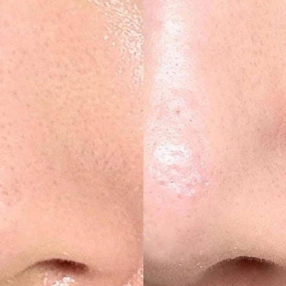 [Ilso] Super Melting Sebum Softener 150ml